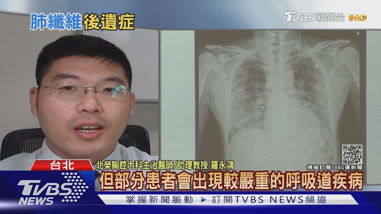 有片／注意！感染新冠肺炎導致「肺部纖維化」　醫師憂爆發這件事