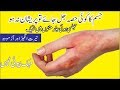 Burn Treatment in Urdu || Ease your Burn at home || Effective treatment of burns at home Burn Treatment in Urdu || Ease your Burn at home || Effective treatment of burns at home