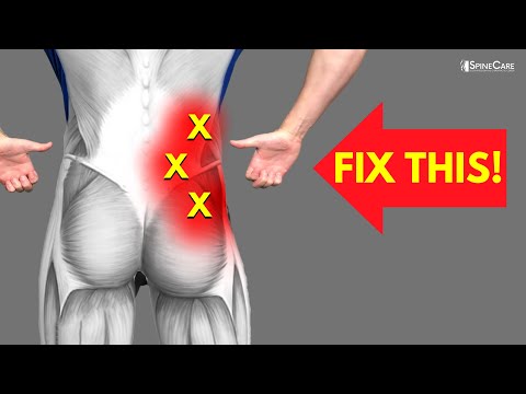 Suffering From Back Pain In One Side? 5 Effective Exercises