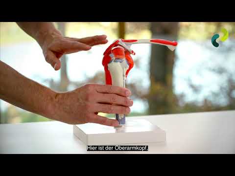 Roland-Klinik: Impingement-Syndrom an der Schulter