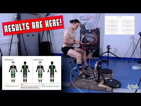 KRIMH - Randmoness 12 - Bewegungsstudie des Sprunggelenks