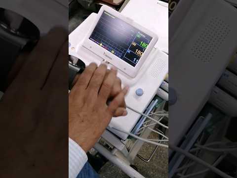 Testing of CTG Machine ✅ Fetal Monitoring 🐣Biomed dude #ctg #fetalmonitor #biomedical #selftest