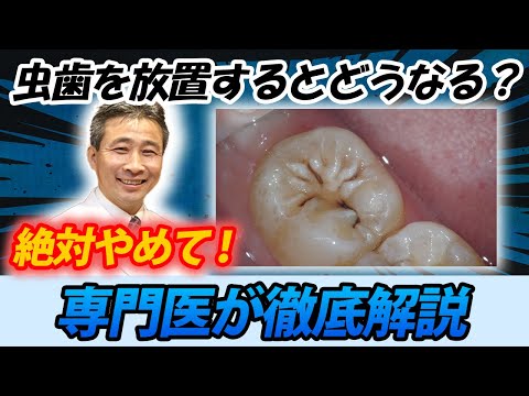 歯学科 【危険！】虫歯を放置すると起こること3選 「歯の専門医が解説」「精密根管治療」「ヒロ横浜デンタル」