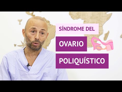 Síndrome del ovario poliquístico (SOP): causas y síntomas