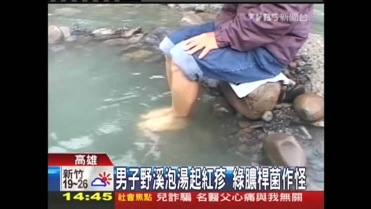 男子野溪泡湯起紅疹　綠膿桿菌作怪