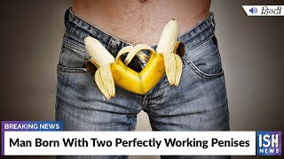 Man Born With Two Perfectly Working Penises