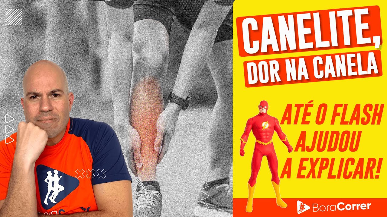 Como prevenir a canelite, ou dor na canela?