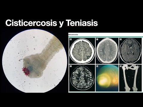 , title : 'Cisticercosis y Teniasis intestinal - Conoce la enfermedad - Parasitos'