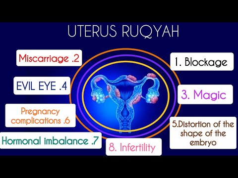 🎧 RUQYAH CURE : UTERUS DISEASES, BLOCKAGE, MAGIC,EVIL EYE, KNOTS, MISCARRIAGE,PREGNANCY COMPLICATION