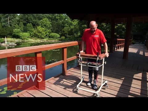 Paralysed man walks again after cell transplant