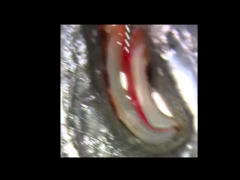 PathFile® - Dr. Gutmann | Dentsply Sirona