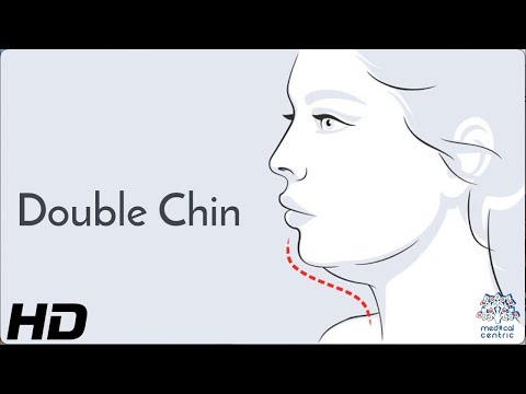 All About Allergy Shots