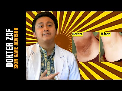 Untuk menurunkan berat badan dengan bantuan sebuah ulasan gizi Hari-hari puasa untuk soba penurunan berat badan dengan yogurt