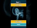 cartilage - cartílago video thumbnail