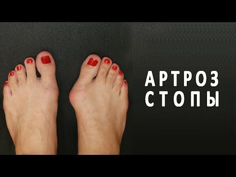 Как болит спина при туберкулезе Снять спазм в грудном отделе позвоночника