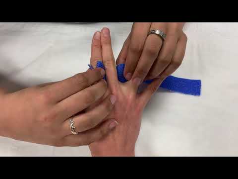 MCP Joint, Anti-Ulnar Drift Orthosis