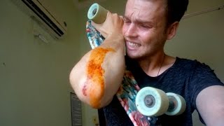 BAD SKATEBOARD FALL - VIETNAM TRAVEL
