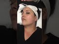 Hydrafacial Lymphatic Drainage Steps
