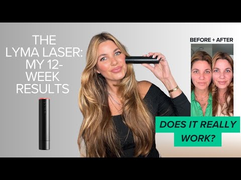 My UNEXPECTED LYMA Laser 12-Week Results