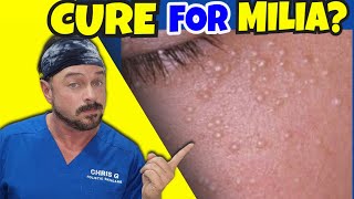 Get Rid Of Milia | Hard White Bumps on Face and Eyes | Chris Gibson