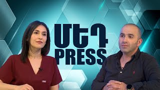 Անոթային հիվանդություններ. որո՞նք են հաճախ հանդիպող անոթային հիվանդությունները