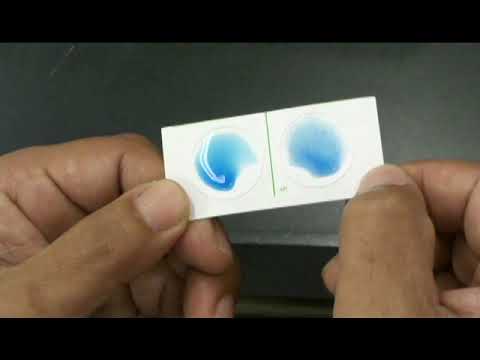 看護学科 Lancefield classificatrion（ランスフィールド分類）