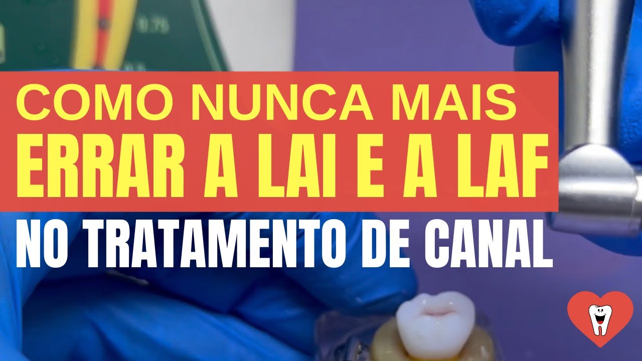 [DICA 100% CLINICA] COMO NUNCA MAIS ERRAR A LAI E A LAF NO TRATAMENTO DE CANAL