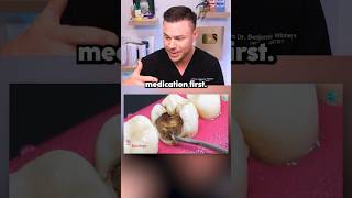 Dentist Reveals What REALLY Happens In A Root Canal! ðŸ˜ðŸ¦·