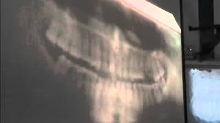 Surgical Radiology - 17 - Biliary System (Revision) + Head & Neck Images