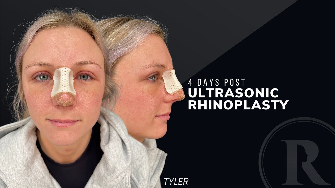 Robb Facial Plastic Surgery