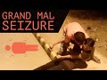 Grand Mal Seizure | Types of seizures | Epilepsy