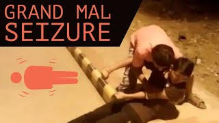Grand Mal Seizure | Types of seizures | Epilepsy