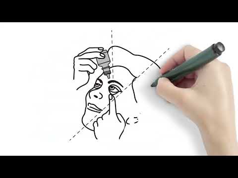 How to Apply Eye Drops