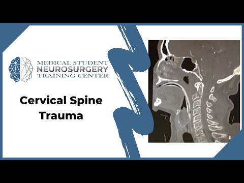 Cervical Spine Trauma