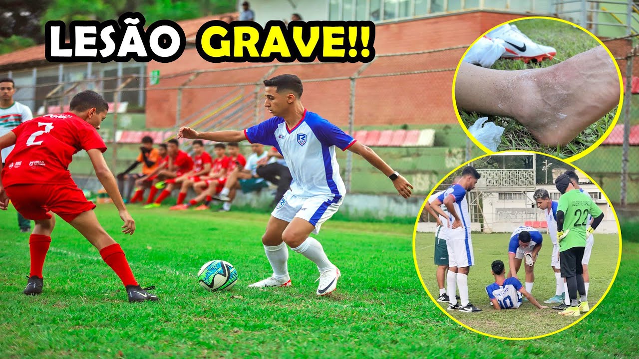 🚨 RIKINHO HURT IN THE FIRST GAME WITH THE GOALKEEPER IN A HELMET ‹ Rikinho ›