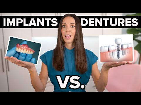 Implants vs. Dentures: The Truth No One Tells You