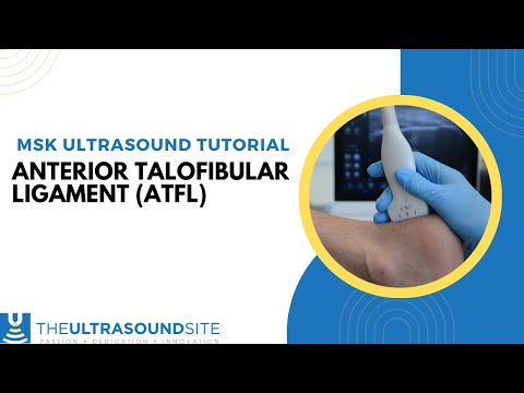 Musculoskeletal ultrasound tutorial - Anterior talofibular ligament