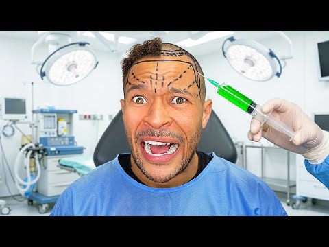 How My Turkey Hair Transplant went WRONG!