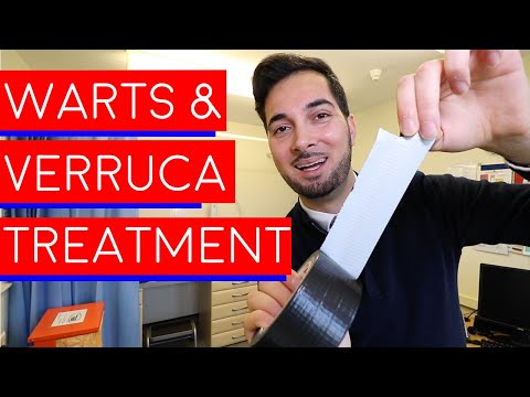Warts | Verrucas | How To Get Rid Of Warts