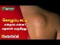 கொழுப்பு கட்டி என்றால் என்ன? எதனால் வருகிறது? Doctor On Call | 31/12/2019