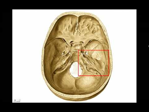 AGUJEROS DE BASE DE CRÁNEO