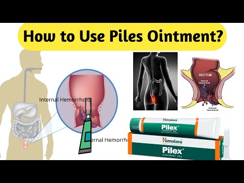 How to Use Piles Ointment