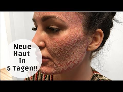 Übungen Kniegelenk zu verbessern Starke Schmerzen im unteren Rücken in der Mitte