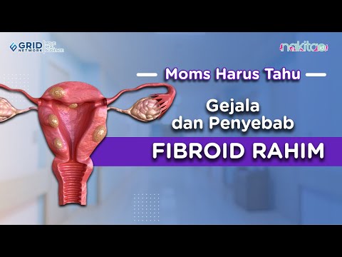 Fibroid Rahim: Waspadai Gejala dan Penyebabnya
