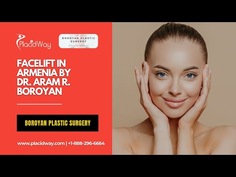 Real Patient Results: Facelift in Armenia by Boroyan Plastic Surgery