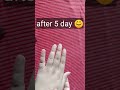 Grow Your Nails Faster Fast Nail Growth Youtubeshorts Shorts Nailsgrow