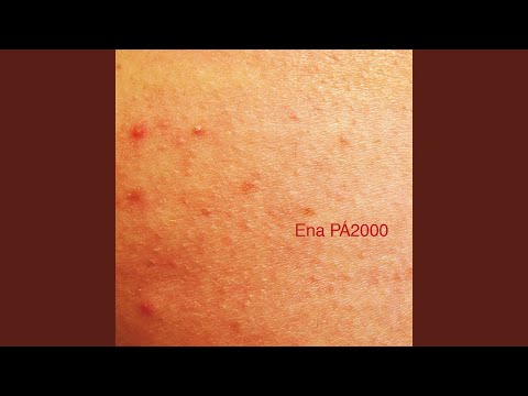 Mulher Portuguesa (Hard)