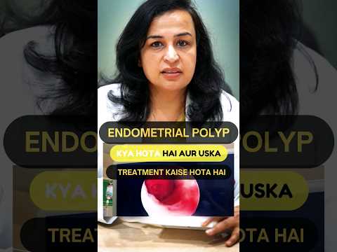 What is an Endometrial Polyp & how's it treated? | Endometrial Polyp in Hindi | Dr. Nymphea Walecha