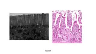 Празно и хълбочно черво – Jejunum, Ileum (9:57) ┃teoriyata.com