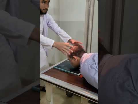 #X-Rays PNS_ PNS 45° degree_ #Examination facial sinuses water_#findings fracture_ plz subscribe